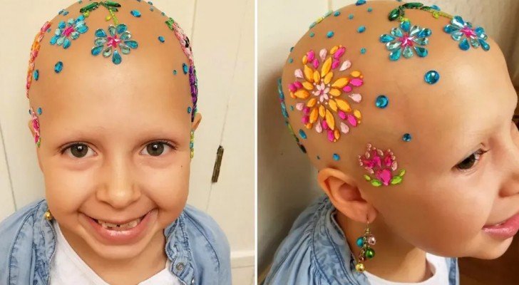 Dieses kleine Mädchen mit Alopezie nimmt am Wettbewerb für extravagante Frisuren teil und gewinnt den ersten Preis